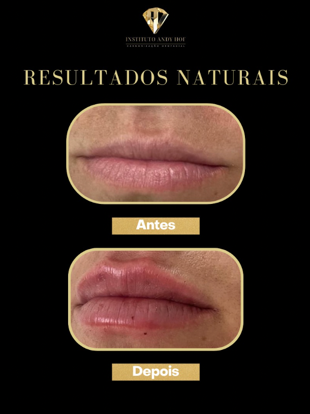 Screenshot 2025-08-06 at 11.00.36