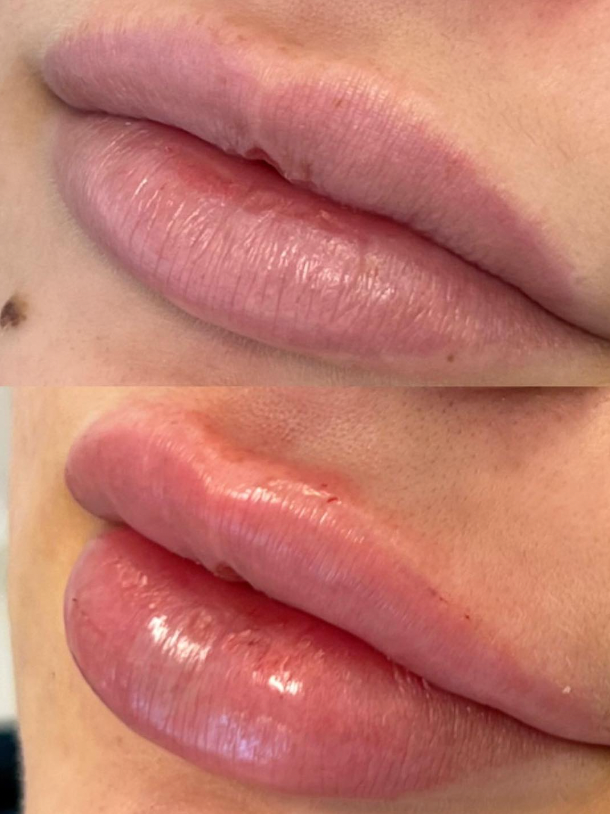 Screenshot 2025-08-06 at 11.10.22