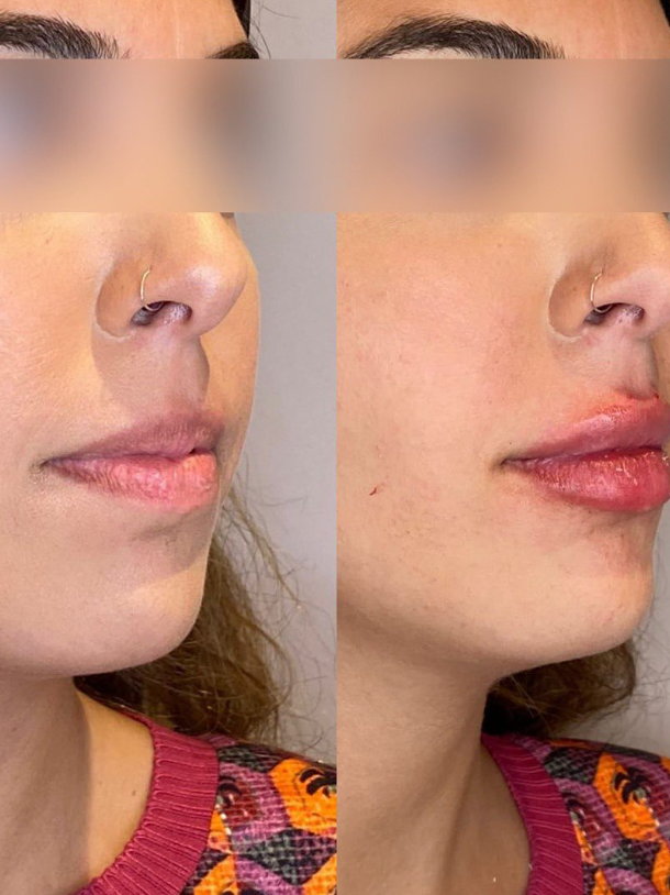 Screenshot 2025-08-06 at 11.10.33